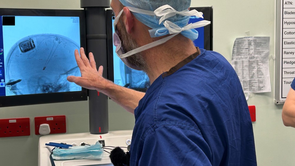Clinician observing MRI scans showing surgical implantation of the Picostim device and electrodes