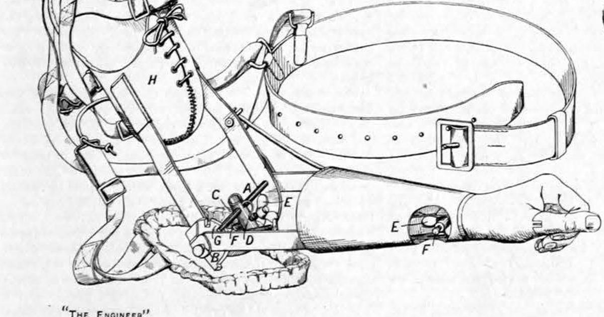 November 1917: prosthetic arms for war casualties