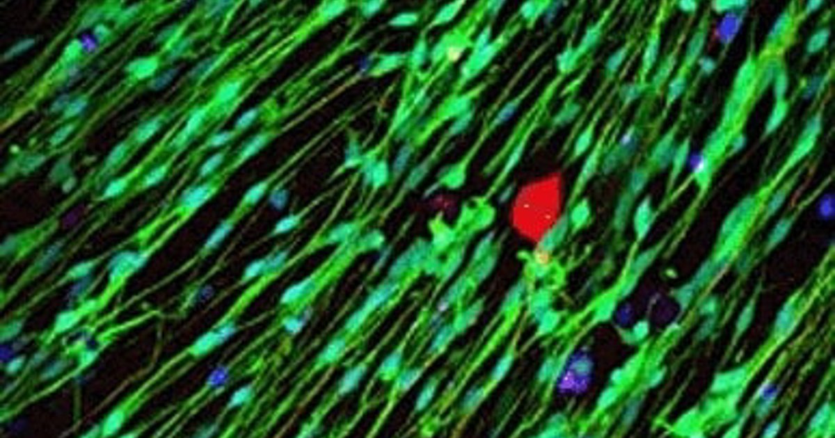 3d-printed-guide-helps-repair-of-damaged-nerves