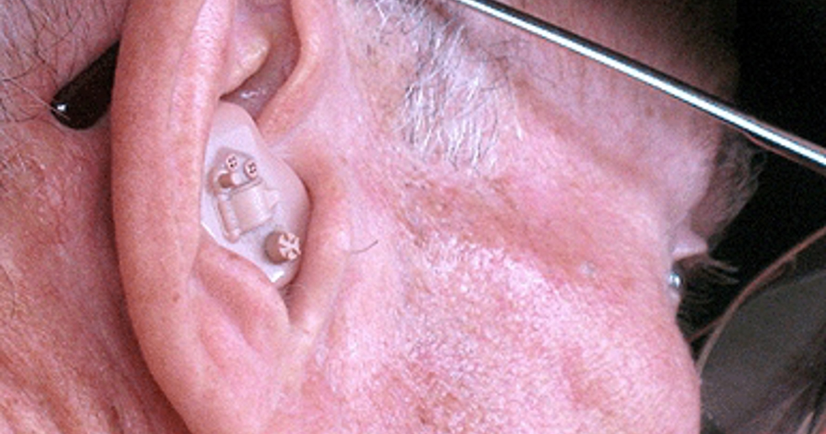 software-could-improve-sound-quality-for-hearing-aid-users