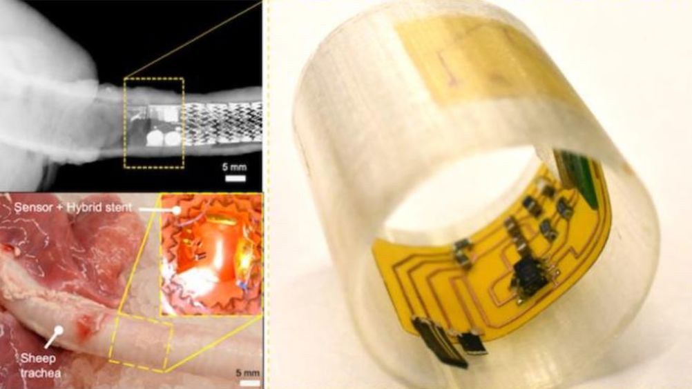 A system of artificial cilia capable of monitoring mucus conditions in human airways to better detect infection, airway obstruction, or the severity of diseases like cystic fibrosis, chronic obstructive pulmonary diseases, and lung cancer