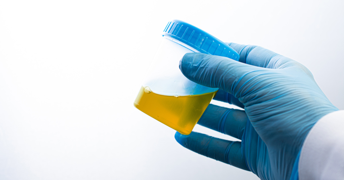 The Engineer - Stick sensor detects cancer in urine